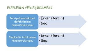 FLEPLERİN YERLEŞİRİLMESİ
 