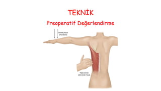 TEKNİK
Preoperatif Değerlendirme
 