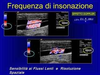 Sensibilità ai Flussi Lenti e RisoluzioneSensibilità ai Flussi Lenti e Risoluzione
SpazialeSpaziale
Frequenza di insonazione
 
