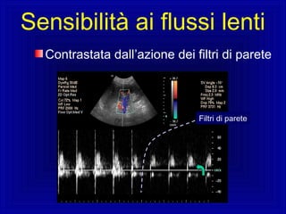 Contrastata dall’azione dei filtri di parete
Sensibilità ai flussi lenti
Filtri di parete
 