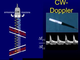 emissione ricezioneCW
CW-
Doppler
∆f(+)
∆f(-)
 