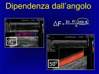 50°
90°
2v Fi cos ø
cF=
Dipendenza dall’angolo
 