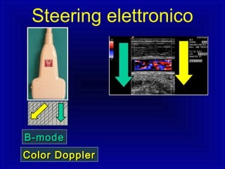 B-modeB-mode
Color DopplerColor Doppler
Steering elettronico
 