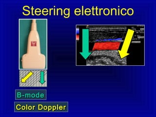 B-modeB-mode
Color DopplerColor Doppler
Steering elettronico
 