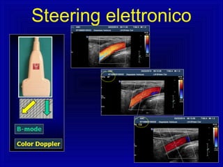 Steering elettronico
 