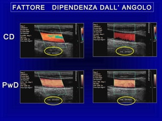 FATTORE DIPENDENZA DALLFATTORE DIPENDENZA DALL ’ ANGOLO’ ANGOLO
CDCD
PwDPwD
 
