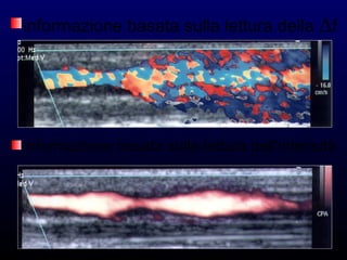 informazione basata sulla lettura della ∆f
informazione basata sulla lettura dell’intensità
 