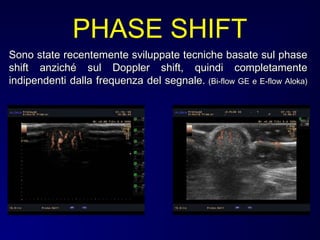 Sono state recentemente sviluppate tecniche basate sul phaseSono state recentemente sviluppate tecniche basate sul phase
shift anziché sul Doppler shift, quindi completamenteshift anziché sul Doppler shift, quindi completamente
indipendenti dalla frequenza del segnale.indipendenti dalla frequenza del segnale. (Bi-flow GE e E-flow Aloka)(Bi-flow GE e E-flow Aloka)
PHASE SHIFT
 