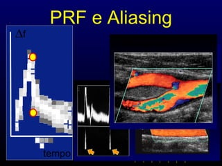 tempo
∆f
PRF e Aliasing
ampiezza
tempo
ampiezza
tempo
Limite di Nyquist
fmax = PRF/2
E’ aliasing o no?
 