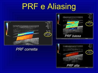 PRF bassaPRF bassa
PRF correttaPRF corretta
PRF altaPRF alta
PRF e Aliasing
 