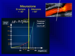 Angolo (ø)
Velocità
cm/ sec
30 60 90
40° 50°
60
50
250
200
150
100
70° 80°
FunzioneFunzione
cosenicacosenica
tra V etra V e øø
2v Fi cos ø
cF=
Misurazione
Si sempre Attenzione
< 60° > 60°
 