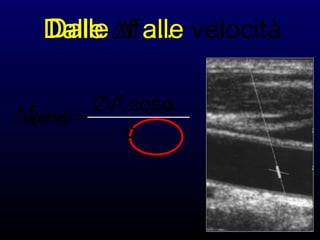 Dalle ∆f …Dalle ∆f alle velocità
(cm/s) =
2Vfi cosα
c
∆f(kHz)
 