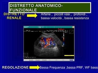 Arterie , piccoli vasi , profondi ,Arterie , piccoli vasi , profondi ,
bassa velocità , bassa resistenzabassa velocità , bassa resistenza
DISTRETTODISTRETTO
RENALERENALE
REGOLAZIONEREGOLAZIONE Bassa Frequenza ,bassa PRF, WF bassi
DISTRETTO ANATOMICO-DISTRETTO ANATOMICO-
FUNZIONALEFUNZIONALE
 