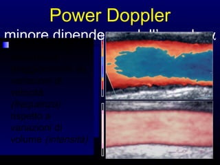 Power Doppler
minore dipendenza dall’angolo α
Minore
percezione del
profilo di flusso
Maggiore
omogeneità del
segnale Doppler
la pulsatilità è
influenzata
maggiormente da
variazioni di
velocità
(frequenza)
rispetto a
variazioni di
volume (intensità)
 