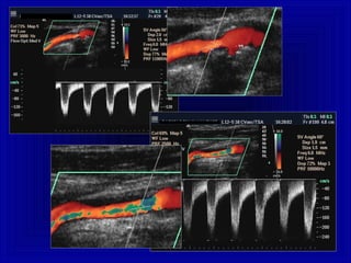 Eco-doppler, Elastosonografia e CEUS: aspetti tecnici