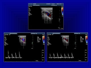 Eco-doppler, Elastosonografia e CEUS: aspetti tecnici