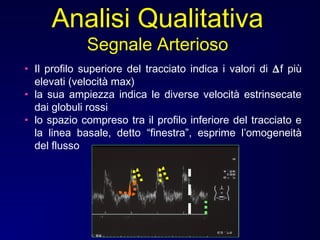 • Il profilo superiore del tracciato indica i valori di ∆f più
elevati (velocità max)
• la sua ampiezza indica le diverse velocità estrinsecate
dai globuli rossi
• lo spazio compreso tra il profilo inferiore del tracciato e
la linea basale, detto “finestra”, esprime l’omogeneità
del flusso
Analisi Qualitativa
Segnale Arterioso
 