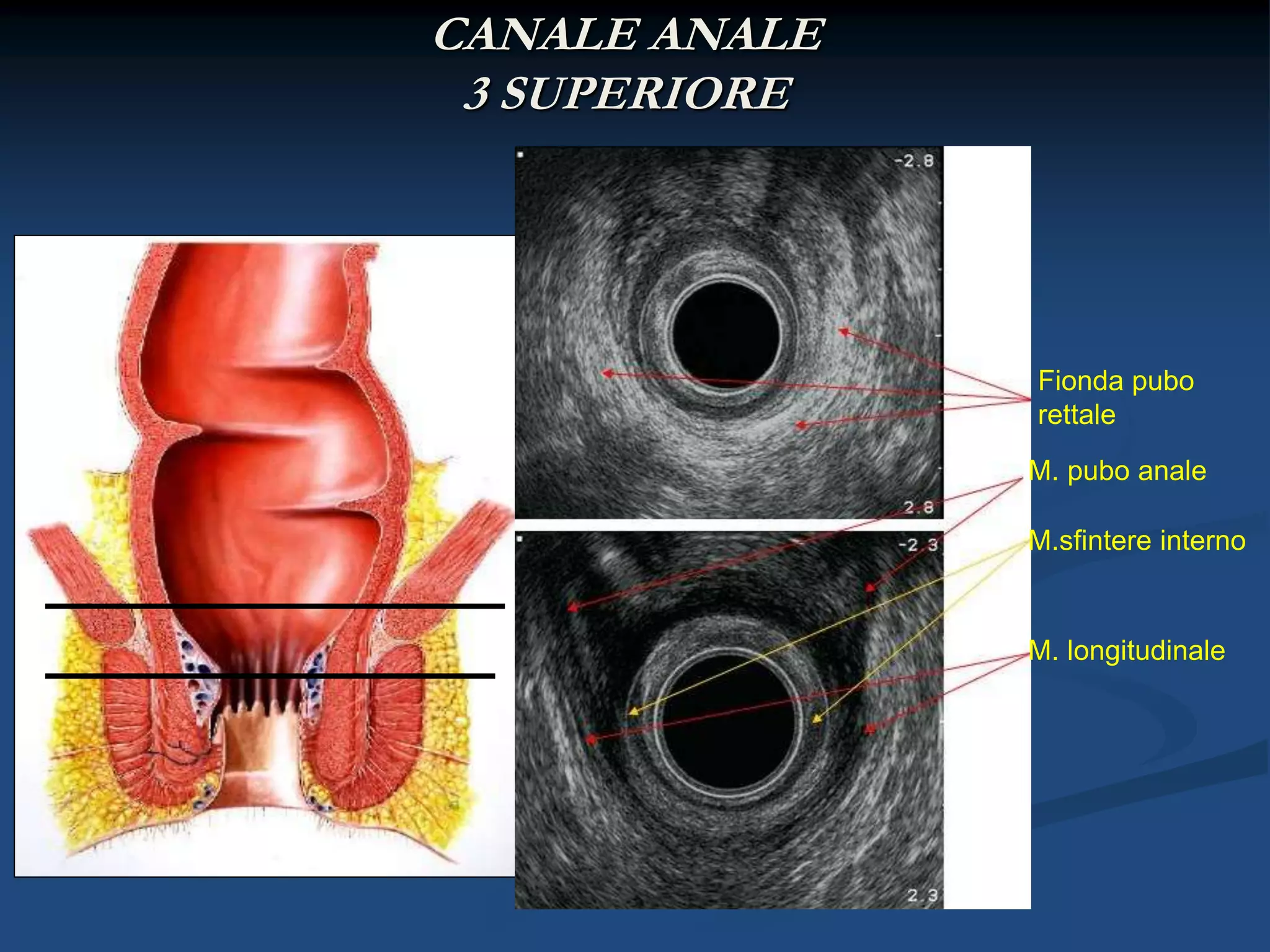 Ecografia canale anale | PPTX