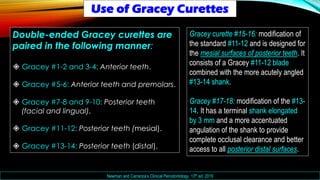 Periodontal Treatment Planning & Phase I Therapy | PDF