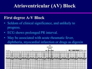 Prof.-Randa-Cardiac-Arrhythmias.ppt