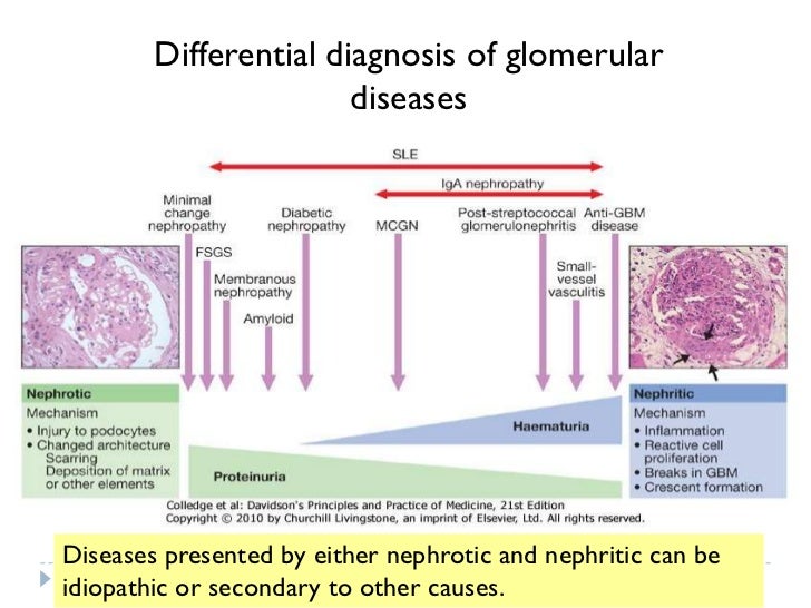 prof e sarhanwork up ofproteinuricpatients 5 728