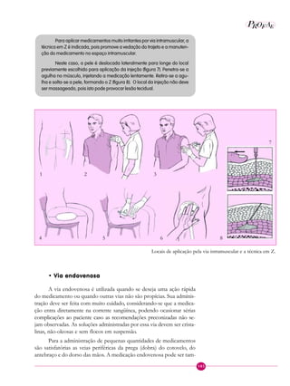 105
P EAROF
Para aplicar medicamentos muito irritantes por via intramuscular, a
técnica em Z é indicada, pois promove a vedação do trajeto e a manuten-
ção do medicamento no espaço intramuscular.
Neste caso, a pele é deslocada lateralmente para longe do local
previamente escolhido para aplicação da injeção (figura 7). Penetra-se a
agulha no músculo, injetando a medicação lentamente. Retira-se a agu-
lha e solta-se a pele, formando o Z (figura 8). O local da injeção não deve
ser massageado, pois isto pode provocar lesão tecidual.
• Via endovenosa
A via endovenosa é utilizada quando se deseja uma ação rápida
do medicamento ou quando outras vias não são propícias. Sua adminis-
tração deve ser feita com muito cuidado, considerando-se que a medica-
ção entra diretamente na corrente sangüínea, podendo ocasionar sérias
complicações ao paciente caso as recomendações preconizadas não se-
jam observadas. As soluções administradas por essa via devem ser crista-
linas, não-oleosas e sem flocos em suspensão.
Para a administração de pequenas quantidades de medicamentos
são satisfatórias as veias periféricas da prega (dobra) do cotovelo, do
antebraço e do dorso das mãos. A medicação endovenosa pode ser tam-
6
7
8
Locais de aplicação pela via intramuscular e a técnica em Z.
1
4 5
2 3
 