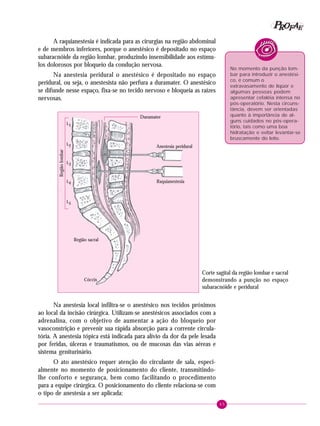 45
PPPPP EEEEEAAAAARRRRROOOOOFFFFF
A raquianestesia é indicada para as cirurgias na região abdominal
e de membros inferiores, porque o anestésico é depositado no espaço
subaracnóide da região lombar, produzindo insensibilidade aos estímu-
los dolorosos por bloqueio da condução nervosa.
Na anestesia peridural o anestésico é depositado no espaço
peridural, ou seja, o anestesista não perfura a duramater. O anestésico
se difunde nesse espaço, fixa-se no tecido nervoso e bloqueia as raízes
nervosas.
No momento da punção lom-
bar para introduzir o anestési-
co, é comum o
extravasamento de líqüor e
algumas pessoas podem
apresentar cefaléia intensa no
pós-operatório. Nesta circuns-
tância, devem ser orientadas
quanto à importância de al-
guns cuidados no pós-opera-
tório, tais como uma boa
hidratação e evitar levantar-se
bruscamente do leito.
Na anestesia local infiltra-se o anestésico nos tecidos próximos
ao local da incisão cirúrgica. Utilizam-se anestésicos associados com a
adrenalina, com o objetivo de aumentar a ação do bloqueio por
vasoconstrição e prevenir sua rápida absorção para a corrente circula-
tória. A anestesia tópica está indicada para alívio da dor da pele lesada
por feridas, úlceras e traumatismos, ou de mucosas das vias aéreas e
sistema geniturinário.
O ato anestésico requer atenção do circulante de sala, especi-
almente no momento de posicionamento do cliente, transmitindo-
lhe conforto e segurança, bem como facilitando o procedimento
para a equipe cirúrgica. O posicionamento do cliente relaciona-se com
o tipo de anestesia a ser aplicada:
Duramater
Anestesia peridural
Raquianestesia
Regiãolombar
L1
L2
L3
L4
L5
Cóccix
Região sacral
Corte sagital da região lombar e sacral
demonstrando a punção no espaço
subaracnóide e peridural
 