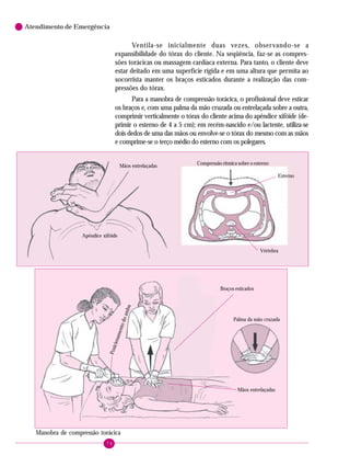 74
Atendimento de Emergência
Ventila-se inicialmente duas vezes, observando-se a
expansibilidade do tórax do cliente. Na seqüência, faz-se as compres-
sões torácicas ou massagem cardíaca externa. Para tanto, o cliente deve
estar deitado em uma superfície rígida e em uma altura que permita ao
socorrista manter os braços esticados durante a realização das com-
pressões do tórax.
Para a manobra de compressão torácica, o profissional deve esticar
os braços e, com uma palma da mão cruzada ou entrelaçada sobre a outra,
comprimir verticalmente o tórax do cliente acima do apêndice xifóide (de-
primir o esterno de 4 a 5 cm); em recém-nascido e/ou lactente, utiliza-se
dois dedos de uma das mãos ou envolve-se o tórax do mesmo com as mãos
e comprime-se o terço médio do esterno com os polegares.
Mãos entrelaçadas
Apêndice xifóide
Compressão rítmica sobre o esterno
Esterno
Vértebra
Posicionamentodoambu
Braços esticados
Mãos entrelaçadas
Palma da mão cruzada
Manobra de compressão torácica
 