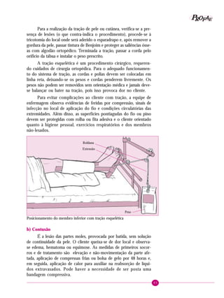 85
PPPPP EEEEEAAAAARRRRROOOOOFFFFF
Para a realização da tração de pele ou cutânea, verifica-se a pre-
sença de lesões (o que contra-indica o procedimento), procede-se à
tricotomia do local onde será aderido o esparadrapo e, após remover a
gordura da pele, passar tintura de Benjoim e proteger as saliências ósse-
as com algodão ortopédico. Terminada a tração, passar a corda pelo
orifício da tábua e instalar o peso prescrito.
A tração esquelética é um procedimento cirúrgico, requeren-
do cuidados de cirurgia ortopédica. Para o adequado funcionamen-
to do sistema de tração, as cordas e polias devem ser colocadas em
linha reta, deixando-se os pesos e cordas penderem livremente. Os
pesos não podem ser removidos sem orientação médica e jamais deve-
se balançar ou bater na tração, pois isso provoca dor no cliente.
Para evitar complicações ao cliente com tração, a equipe de
enfermagem observa evidências de feridas por compressão, sinais de
infecção no local de aplicação do fio e condições circulatórias das
extremidades. Além disso, as superfícies pontiagudas do fio ou pino
devem ser protegidas com rolha ou fita adesiva e o cliente orientado
quanto à higiene pessoal, exercícios respiratórios e dos membros
não-lesados.
b) Contusão
É a lesão das partes moles, provocada por batida, sem solução
de continuidade da pele. O cliente queixa-se de dor local e observa-
se edema, hematoma ou equimose. As medidas de primeiros socor-
ros e de tratamento são elevação e não-movimentação da parte afe-
tada, aplicação de compressas frias ou bolsa de gelo por 48 horas e,
em seguida, aplicação de calor para auxiliar na reabsorção de líqui-
dos extravasados. Pode haver a necessidade de ser posta uma
bandagem compressiva.
Posicionamento do membro inferior com tração esquelética
Roldana
Extensão
Peso
 