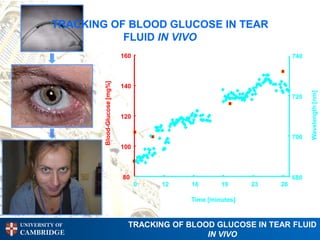 TRACKING OF BLOOD GLUCOSE IN TEAR
                    FLUID IN VIVO
                                       160                                       740




                 Blood-Glucose [mg%]
                                       140




                                                                                       Wavelength [nm]
                                                                                 720


                                       120


                                                                                 700
                                       100



                                       80                                        680
                                             0   12   16       19      23   26

                                                      Time [minutes]


UNIVERSITY OF                            TRACKING OF BLOOD GLUCOSE IN TEAR FLUID
CAMBRIDGE                                                IN VIVO
 