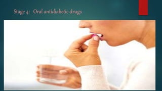 Stage 4: Oral antidiabetic drugs
 