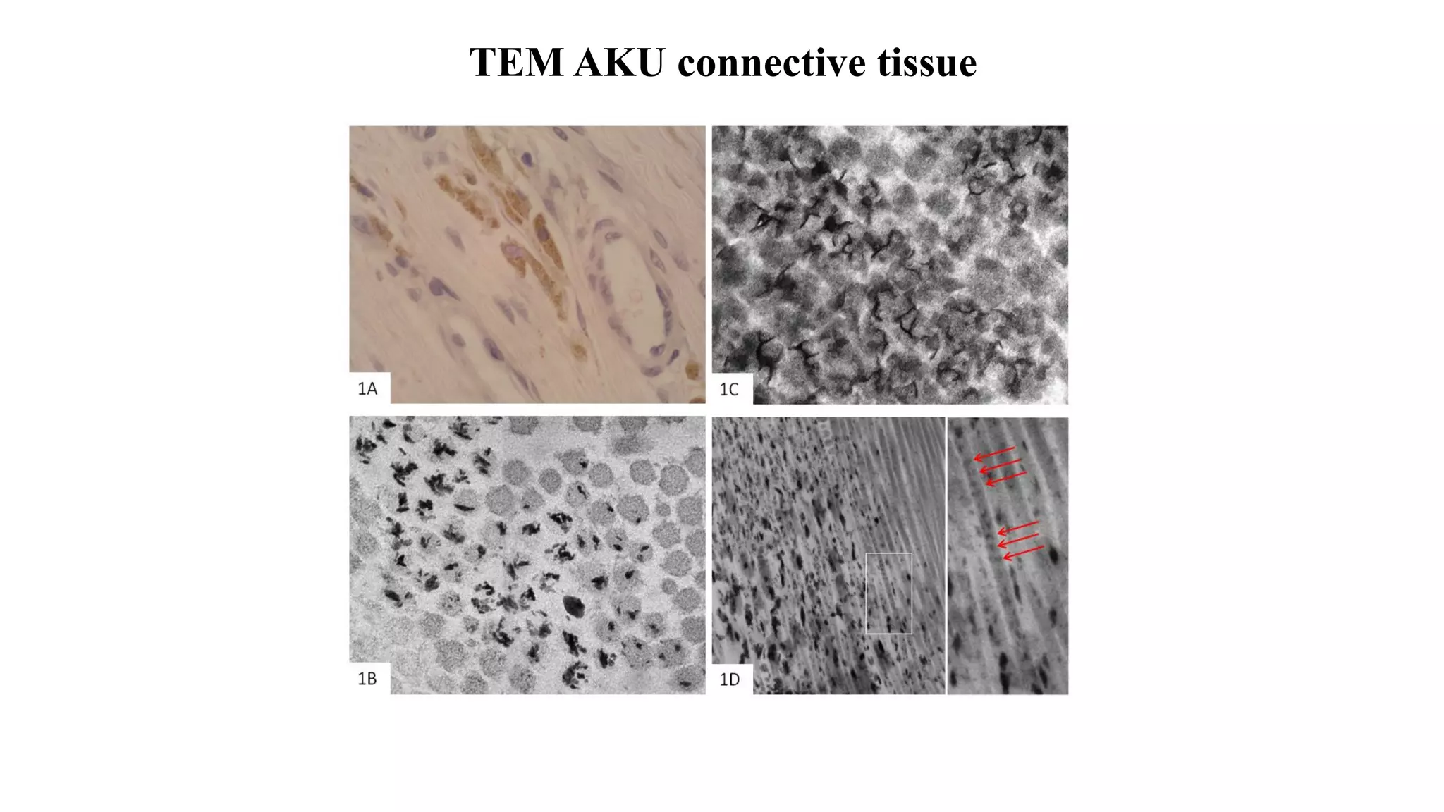 Professor Lakshminarayan Ranganath Wholegenome sequencing to unders…