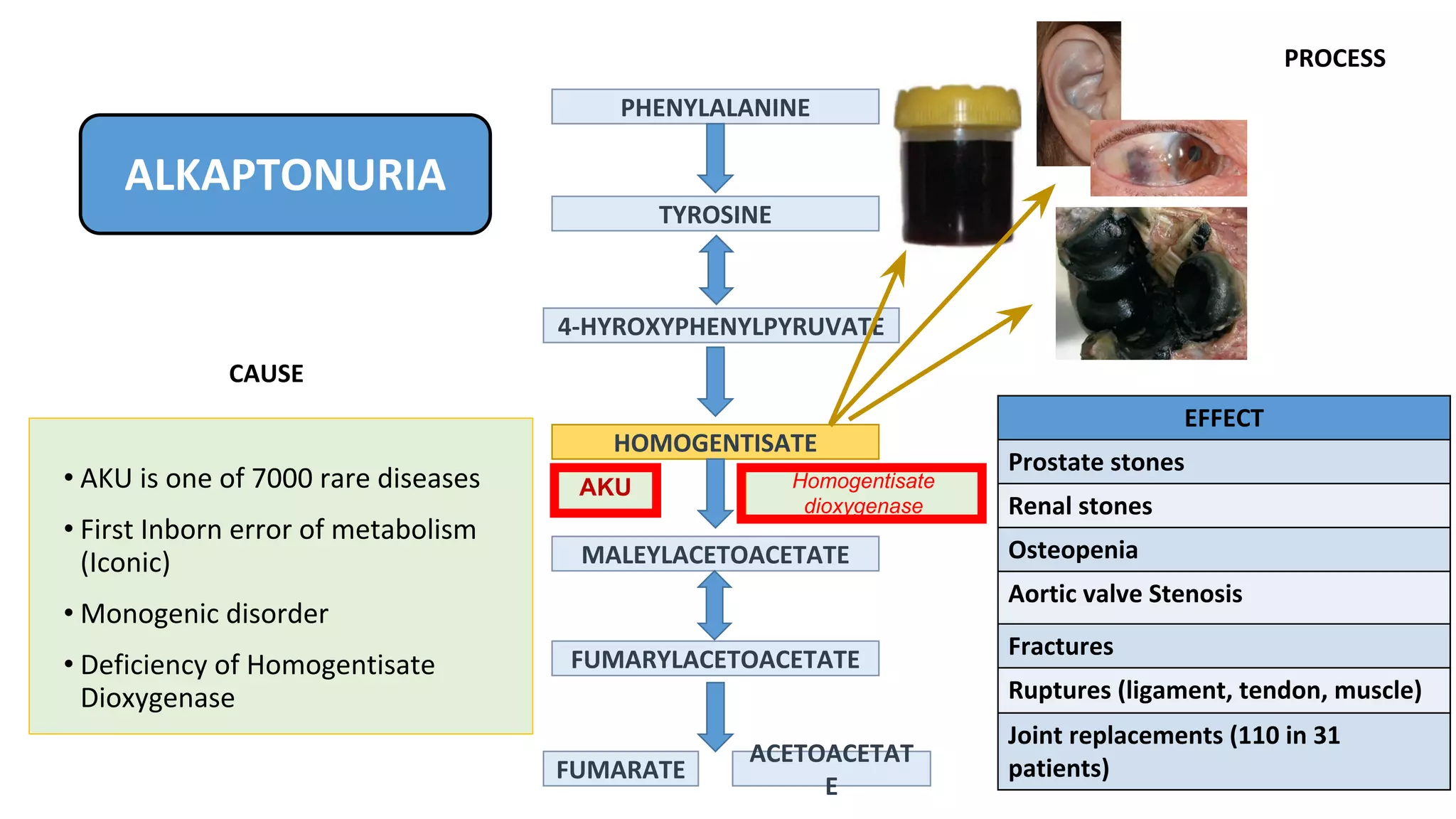 Professor Lakshminarayan Ranganath Wholegenome sequencing to unders…