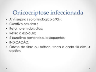 Onicocriptose infeccionada
• Antissepsia ( soro fisiológico 0,9%);
• Curativo oclusivo ;
• Retorno em dois dias;
• Retira a espícula;
• 2 curativos semanais sub sequentes;
• INDICAÇÃO:
• Órtese de fibra ou bótton, troca a cada 20 dias, 4
sessões.
 