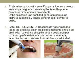 8. El abrasivo se deposita en el Dappen y luego se coloca

en la copa de goma o en el cepillo, también puede
colocarse directamente en el diente.
Debe colocarse una cantidad generosa porque no
lustra la superficie y puede generar calor e irritar la
pulpa.
9. FASE DE PULIMIENTO: Después de haber raspado

todas las áreas se pulen las piezas mediante ángulo de
profilaxis. (La copa y el cepillo deben deslizarse por
toda la superficie dentaria con presión moderada,
intermitente, con movimientos circulares y velocidad
media)

 