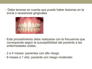 • Debe tenerse en cuenta que puede haber lesiones en la

encía o recesiones gingivales

• Este procedimiento debe realizarse con la frecuencia que

corresponde según la susceptibilidad del paciente a las
enfermedades orales.
• 2 a 4 meses: pacientes con alto riesgo

• 6 meses a 1 año: paciente con riesgo moderado

 