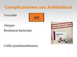 Complicaciones uso Antibióticos
Toxicidad


Alergias
Resistencia bacteriana



Colitis pseudomembranosa
 