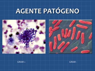 AGENTE PATÓGENO




GRAM +      GRAM -
 