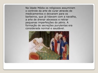 Na Idade Média os religiosos assumiram
o controle da arte de curar através de
medicamentos e deixaram para os
barbeiros, que já lidavam com a navalha,
a arte de drenar abcessos e retirar
pequenas imperfeições do pénis. A
formação de secreções purulentas era
considerada normal e saudável.
 