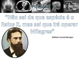 Willhelm Conrad Röentgen
 