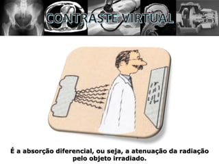 É a absorção diferencial, ou seja, a atenuação da radiação
pelo objeto irradiado.
 