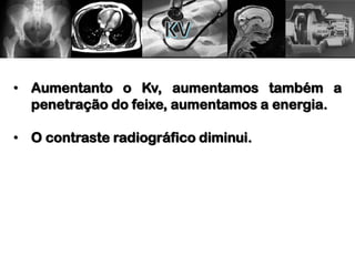• Aumentanto o Kv, aumentamos também a
penetração do feixe, aumentamos a energia.
• O contraste radiográfico diminui.
 
