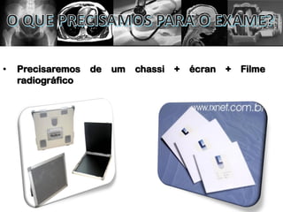 • Precisaremos de um chassi + écran + Filme
radiográfico
 
