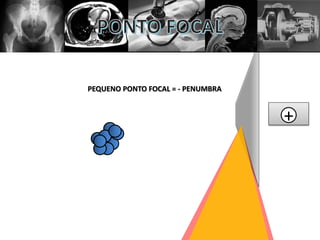 +
PEQUENO PONTO FOCAL = - PENUMBRA
 