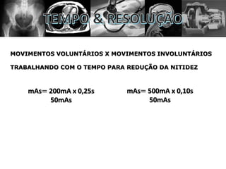MOVIMENTOS VOLUNTÁRIOS X MOVIMENTOS INVOLUNTÁRIOS
TRABALHANDO COM O TEMPO PARA REDUÇÃO DA NITIDEZ
mAs= 200mA x 0,25s
50mAs
mAs= 500mA x 0,10s
50mAs
 