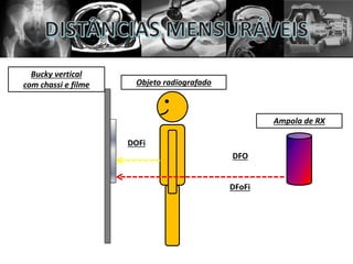 DOFi
DFoFi
Ampola de RX
Bucky vertical
com chassi e filme Objeto radiografado
DFO
 