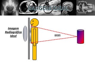DFOFI
Imagem
Radiográfica
Ideal
 