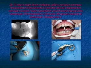 До 10 марта жюри были отобраны работы,которые наглядноДо 10 марта жюри были отобраны работы,которые наглядно
показывали использование в практике врачей современныхпоказывали использование в практике врачей современных
методов лечения.Также оценивался эстетический результат(вметодов лечения.Также оценивался эстетический результат(в
номинации «Реставрация») и качество обтурации каналов (вноминации «Реставрация») и качество обтурации каналов (в
номинации «Эндодонтия»).номинации «Эндодонтия»).
 