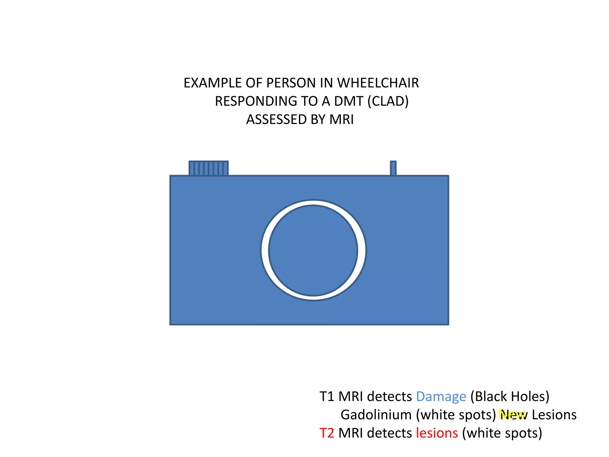 No New Lesions
T1 MRI detects Damage (Black Holes)
Gadolinium (white spots) New Lesions
T2 MRI detects lesions (white spots)
New
EXAMPLE OF PERSON IN WHEELCHAIR
RESPONDING TO A DMT (CLAD)
ASSESSED BY MRI
 