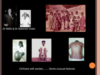 Cirrhosis with ascites……. Some unusual features
Dr NMG & Dr Solomon Victor
 